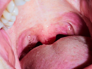 Fotoschule-Koeln | Fotokurse in K&ouml;ln | 